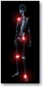 X-ray full body