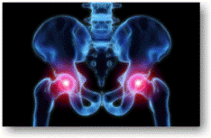X-ray of hip joints
